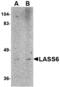Ceramide Synthase 6 antibody, MBS150712, MyBioSource, Western Blot image 