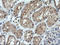 Cancer/Testis Antigen 1B antibody, LS-C174583, Lifespan Biosciences, Immunohistochemistry paraffin image 