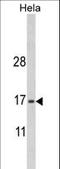 Protein Mpv17 antibody, LS-C164616, Lifespan Biosciences, Western Blot image 