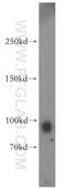 Kinesin Family Member 19 antibody, 19551-1-AP, Proteintech Group, Western Blot image 
