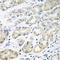 Major Histocompatibility Complex, Class II, DM Beta antibody, STJ110682, St John