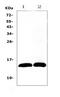 Spasmolytic polypeptide antibody, A07013-2, Boster Biological Technology, Western Blot image 