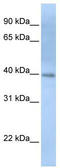 Inositol-tetrakisphosphate 1-kinase antibody, TA334502, Origene, Western Blot image 
