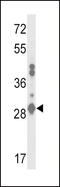 Glutathione S-transferase A2 antibody, LS-C166704, Lifespan Biosciences, Western Blot image 