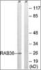 Abhydrolase Domain Containing 6 antibody, orb314051, Biorbyt, Western Blot image 