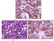 BLK Proto-Oncogene, Src Family Tyrosine Kinase antibody, STJ97868, St John