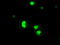 Serine/threonine-protein kinase PRKY antibody, TA500560, Origene, Immunofluorescence image 