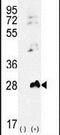 Adenylate Kinase 1 antibody, PA5-15484, Invitrogen Antibodies, Western Blot image 