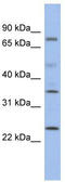 Protein phosphatase 1K, mitochondrial antibody, TA338871, Origene, Western Blot image 