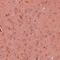 Spindle And Kinetochore Associated Complex Subunit 1 antibody, orb75276, Biorbyt, Immunohistochemistry paraffin image 