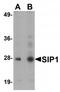 Gem Nuclear Organelle Associated Protein 2 antibody, TA319750, Origene, Western Blot image 