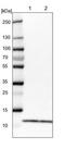 Ribosomal Protein S21 antibody, NBP1-87100, Novus Biologicals, Western Blot image 