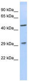 Limb And CNS Expressed 1 antibody, TA337847, Origene, Western Blot image 