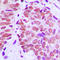 X-Ray Repair Cross Complementing 5 antibody, LS-C353016, Lifespan Biosciences, Immunohistochemistry paraffin image 