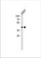 APOL1 antibody, TA324930, Origene, Western Blot image 