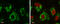 Glutaminase antibody, GTX131263, GeneTex, Immunofluorescence image 