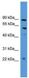 PDZ Domain Containing 1 antibody, TA346092, Origene, Western Blot image 