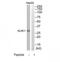 Killer Cell Lectin Like Receptor C1 antibody, TA314139, Origene, Western Blot image 