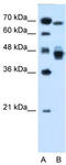 Nuclear receptor subfamily 2 group F member 6 antibody, TA338164, Origene, Western Blot image 