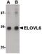 ELOVL Fatty Acid Elongase 6 antibody, PA5-20520, Invitrogen Antibodies, Western Blot image 