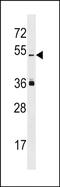 Leucine-rich repeat-containing protein PRAME-like antibody, PA5-72103, Invitrogen Antibodies, Western Blot image 