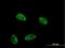 DUSP4 antibody, H00001846-M08, Novus Biologicals, Immunocytochemistry image 