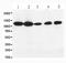 Hypoxia-inducible factor 1-alpha antibody, PA1041, Boster Biological Technology, Western Blot image 