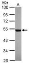 Ral Guanine Nucleotide Dissociation Stimulator Like 4 antibody, GTX119584, GeneTex, Western Blot image 