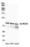 Kinesin-like protein KIF2C antibody, A300-807A, Bethyl Labs, Western Blot image 