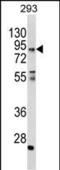 Coiled-Coil Alpha-Helical Rod Protein 1 antibody, PA5-35335, Invitrogen Antibodies, Western Blot image 