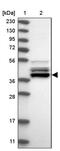 Uroporphyrinogen decarboxylase antibody, PA5-55939, Invitrogen Antibodies, Western Blot image 