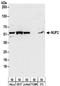NUF2 Component Of NDC80 Kinetochore Complex antibody, NBP2-32211, Novus Biologicals, Western Blot image 