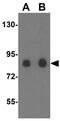Doublecortin Like Kinase 2 antibody, GTX31404, GeneTex, Western Blot image 