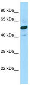 Succinate-CoA Ligase GDP-Forming Beta Subunit antibody, TA333987, Origene, Western Blot image 