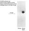 Small conductance calcium-activated potassium channel protein 3 antibody, TA338528, Origene, Western Blot image 