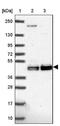 Polyribonucleotide 5 -hydroxyl-kinase Clp1 antibody, NBP2-33847, Novus Biologicals, Western Blot image 