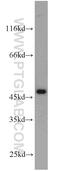 Alcohol Dehydrogenase 7 (Class IV), Mu Or Sigma Polypeptide antibody, 23425-1-AP, Proteintech Group, Western Blot image 