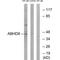 Abhydrolase Domain Containing 8 antibody, A18322, Boster Biological Technology, Western Blot image 