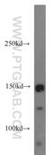 Ubiquitin Specific Peptidase 42 antibody, 18811-1-AP, Proteintech Group, Western Blot image 