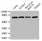 Liver carboxylesterase N antibody, A53546-100, Epigentek, Western Blot image 