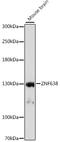 Zinc Finger Protein 638 antibody, 16-256, ProSci, Western Blot image 