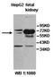 6-Phosphofructo-2-Kinase/Fructose-2,6-Biphosphatase 3 antibody, orb77956, Biorbyt, Western Blot image 
