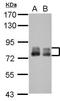 Phospholipase A2 Activating Protein antibody, GTX115226, GeneTex, Western Blot image 