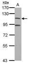 Mdm2-binding protein antibody, GTX115838, GeneTex, Western Blot image 