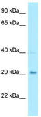Carbonic Anhydrase 7 antibody, TA342844, Origene, Western Blot image 