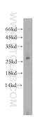 DnaJ Heat Shock Protein Family (Hsp40) Member B8 antibody, 17071-1-AP, Proteintech Group, Western Blot image 