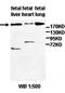 Zinc Finger FYVE-Type Containing 9 antibody, orb77801, Biorbyt, Western Blot image 