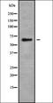 Solute carrier family 22 member 4 antibody, orb338520, Biorbyt, Western Blot image 