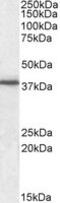 F11 Receptor antibody, MBS421976, MyBioSource, Western Blot image 