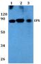 Eosinophil Peroxidase antibody, A05098, Boster Biological Technology, Western Blot image 